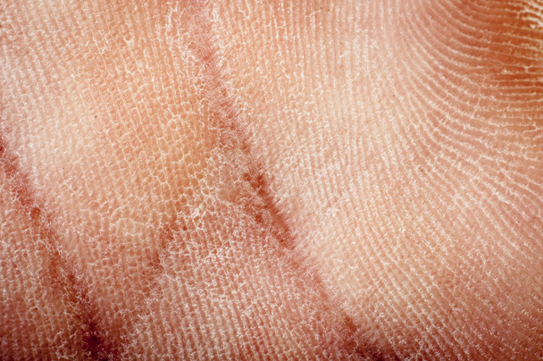 Human dried skin - Photo, Image
