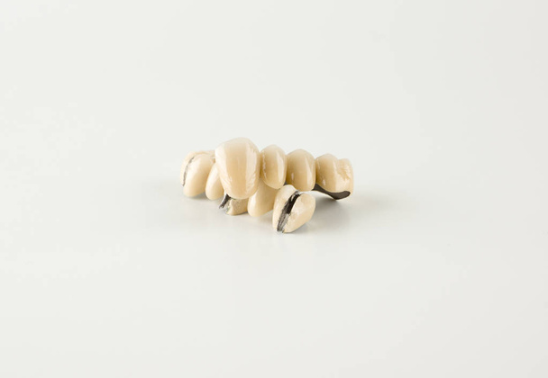 Daño de dentadura por masa cerámica
 - Foto, imagen