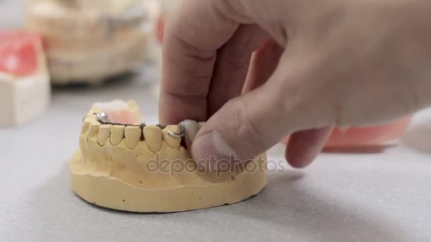 ein Modell des Kiefers eines Mannes, der eine Zahnkrone entfernt und falsche Zähne nimmt - Filmmaterial, Video