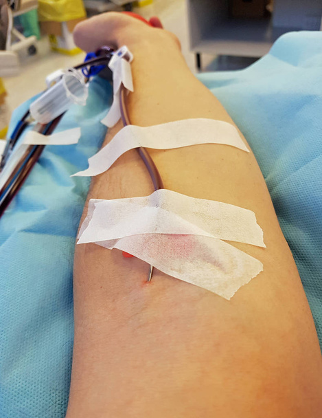 Brazo de un donante de sangre con la aguja quirúrgica
 - Foto, Imagen