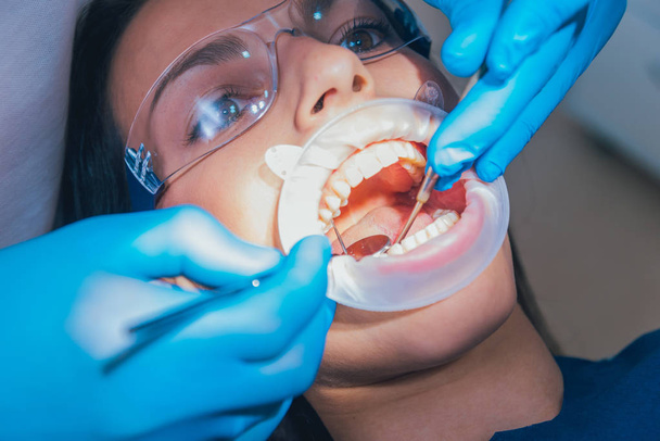 Dental treatment with expander.  - Fotó, kép
