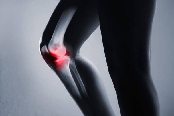 Lidský kolenní kloub a noha na rentgenu, na šedém pozadí - Fotografie, Obrázek