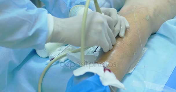 Πρωτοποριακή μέθοδος χειρουργικής φλεβίτιδα, σκληροθεραπεία διαδικασία. Γκρο πλαν βολή των ποδιών του ασθενούς - Πλάνα, βίντεο