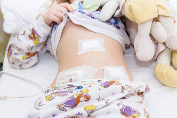Την κοιλιά του παιδιού preschooler με patch και καθετήρα μετά με τρίτε - Φωτογραφία, εικόνα