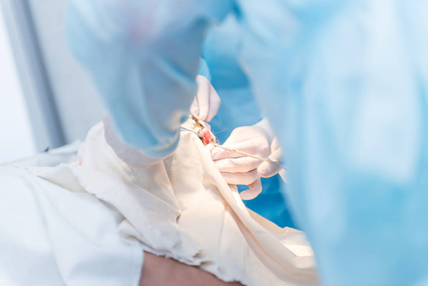 rękach lekarzy chirurgów robi operacji pacjenta w - Zdjęcie, obraz