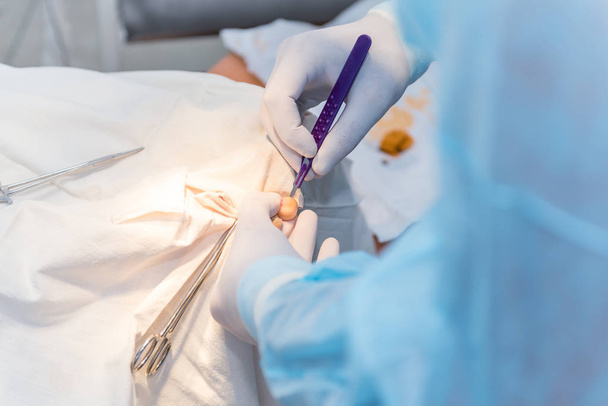 hands of surgeon doctor doing surgery on woman's toe. Concept ph - Foto, Bild