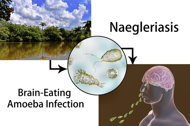 Forma flagellata del parassita Naegleria fowleri
 - Foto, immagini