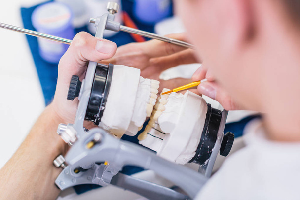 Técnico dentário ou dentista trabalhando com próteses dentárias em seu laboratório, fabricação de coroas de cerâmica
 - Foto, Imagem