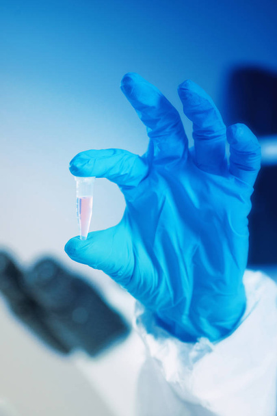 Muestra de prueba de mano en laboratorio en guante azul
 - Foto, Imagen