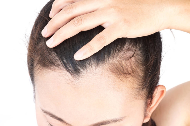 Жінка серйозна проблема випадіння волосся для охорони здоров'я шампунь і концепція косметичного продукту
 - Фото, зображення
