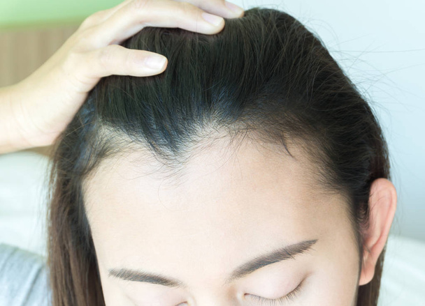 Donna grave problema di perdita dei capelli per shampoo sanitario e concetto di prodotto di bellezza
 - Foto, immagini