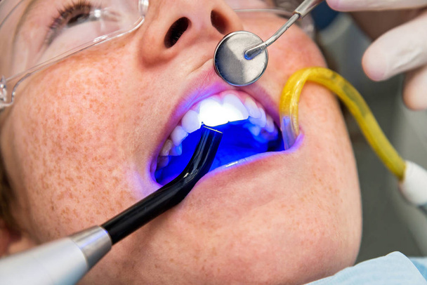 Dentist makes teeth checkup child using an ultraviolet lamp - Фото, зображення