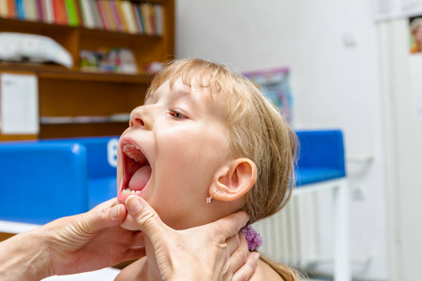 Lekarz, pediatra jest kontrola, badanie jamy ustnej małej dziewczynki  - Zdjęcie, obraz