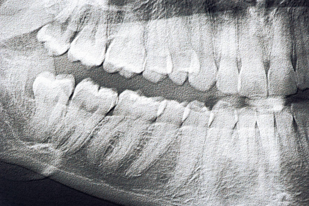 Radiografía panorámica de la mandíbula del hombre de cerca
 - Foto, Imagen