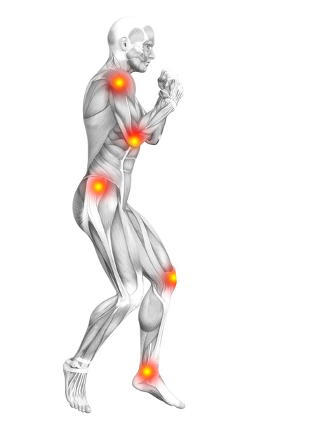 Konzeptionelle menschliche Muskelanatomie mit roter und gelber Hotspot-Entzündung, Osteoporose, Sportkonzept   - Foto, Bild