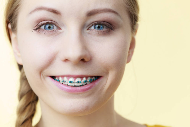 Young woman showing teeth braces - Foto, imagen
