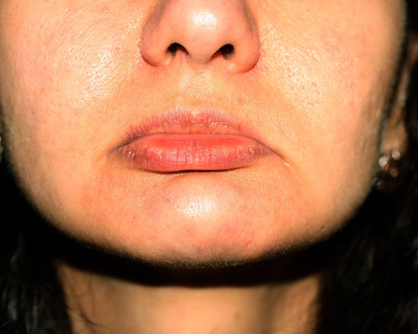 Lippen mit abgesenkten Ecken. Falten auf den Lippen. Nasolabialfalten - Foto, Bild