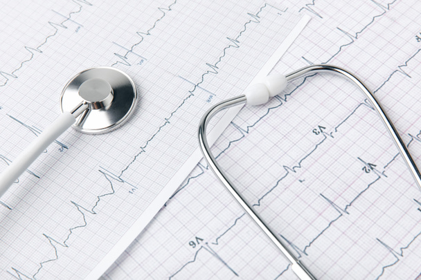 stetoscopio posato su carta con cardiogramma isolato su fondo bianco
      - Foto, immagini