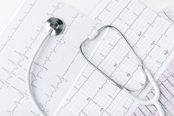 stethoscoop opleggen van papier met cardiogram geïsoleerd op witte achtergrond     - Foto, afbeelding