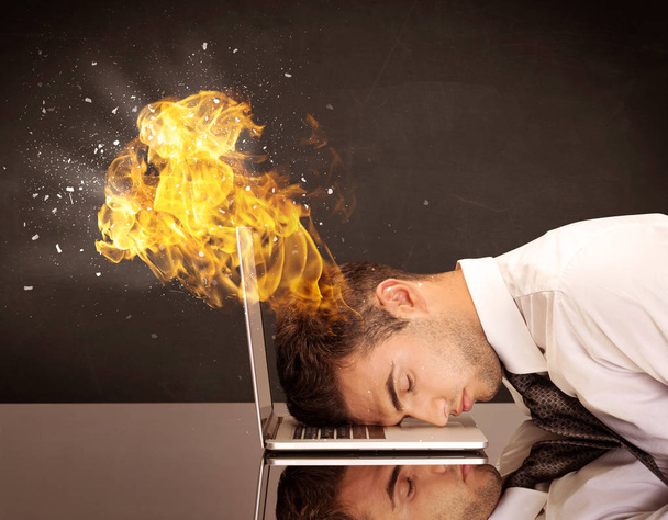 ストレスの多いビジネスマンの頭が燃えてる - 写真・画像