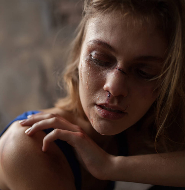 Retrato de mujer triste llorando víctima de violencia doméstica y abuso con moretones, heridas y lágrimas en la cara
.  - Foto, Imagen