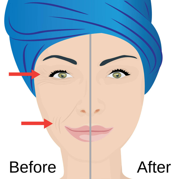 Envelhecimento tratamento facial. Antes e depois
 - Vetor, Imagem