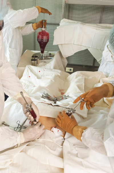 beenmergtransplantatie operatie - Foto, afbeelding