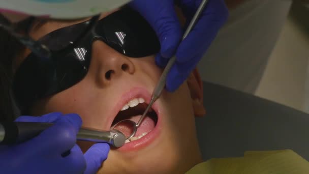 Closeup little kid during procedure of teeth drilling treatment at dentist clinic office - Filmati, video