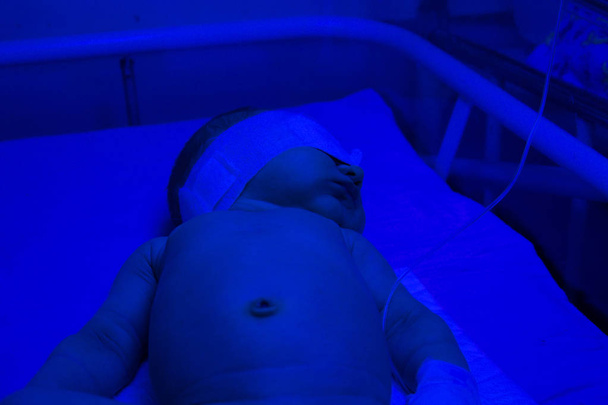 Neugeborenes zur Behandlung von Gelbsucht im Krankenhaus - Foto, Bild