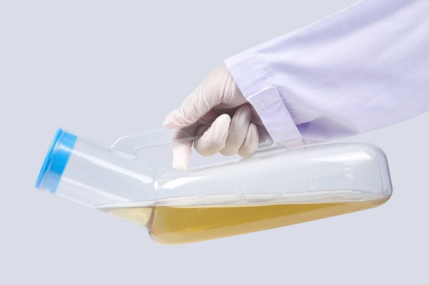 Médico de mano sosteniendo plástico urinario portátil
 - Foto, imagen
