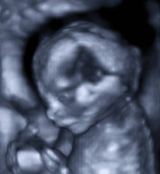 Ultraschall 3D-Bild des Babys im Mutterleib. - Foto, Bild
