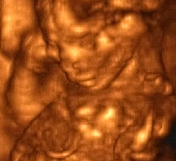 Ultrasonografia 3D Analisi di un feto di quarto mese, Laboratori Italiani - Foto, immagini