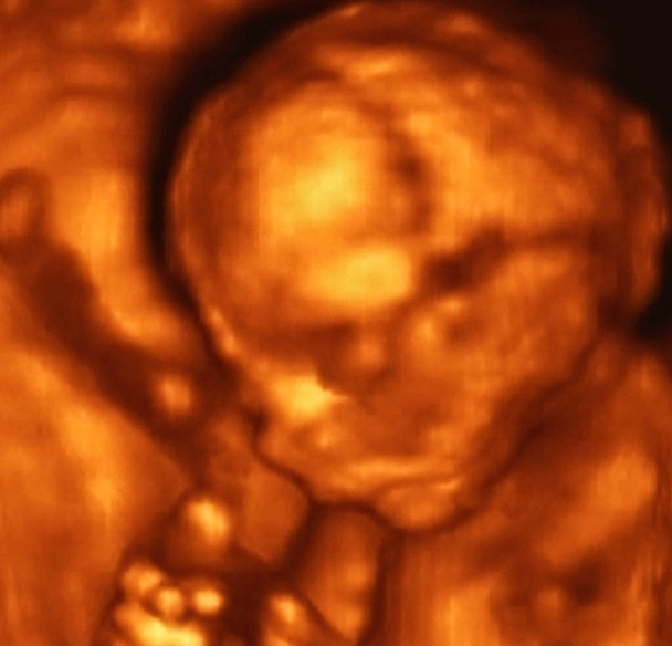 Echographie Analyse d'un 4ème mois Fœtus, Italie - Photo, image