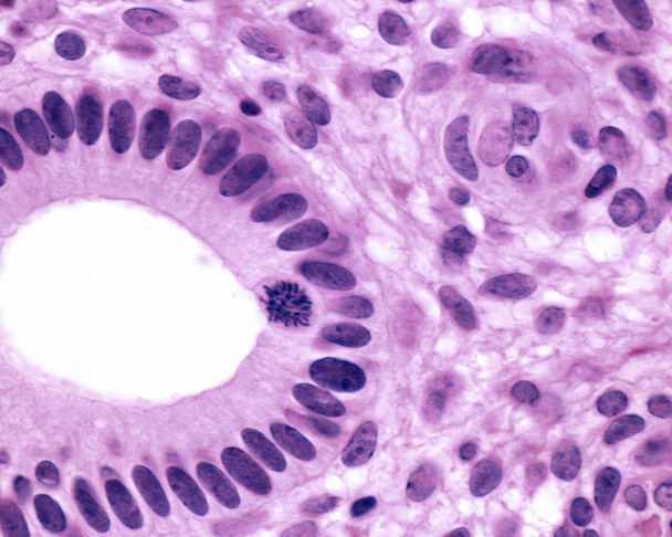 Glandula uterina
 - Foto, Imagem