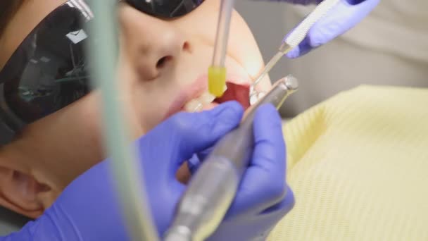 Closeup little kid during procedure of teeth drilling treatment at dentist clinic office - Video, Çekim