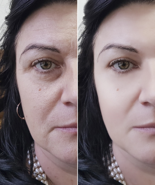 Kobieta zmarszczki twarzy przed i po - Zdjęcie, obraz