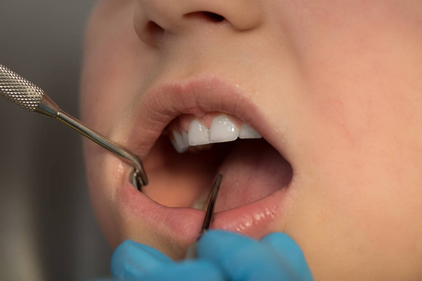 Dientes de mujer y un espejo bucal del dentista. el dentista que realiza una inspección
 - Foto, Imagen
