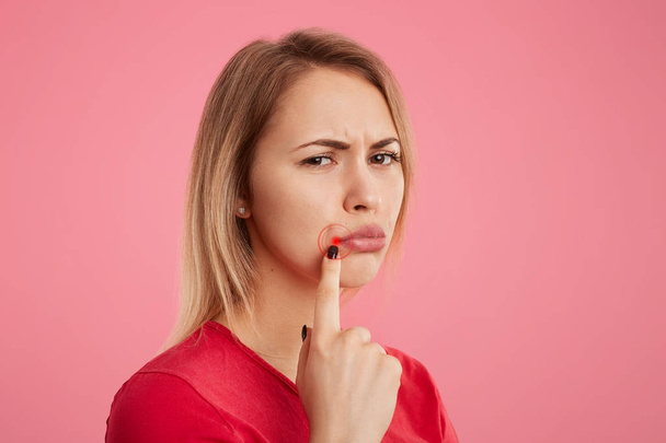 Discontent young beautiful female with unhappy look, has oral herpes, indicates at wound near lips, stands sideways against pink background. People, skin care and health problems concept. - Fotoğraf, Görsel