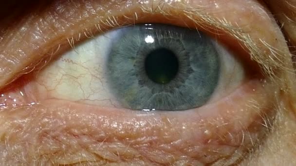 Un occhio solo di vecchio con i capillari rossi. Macro
 - Filmati, video