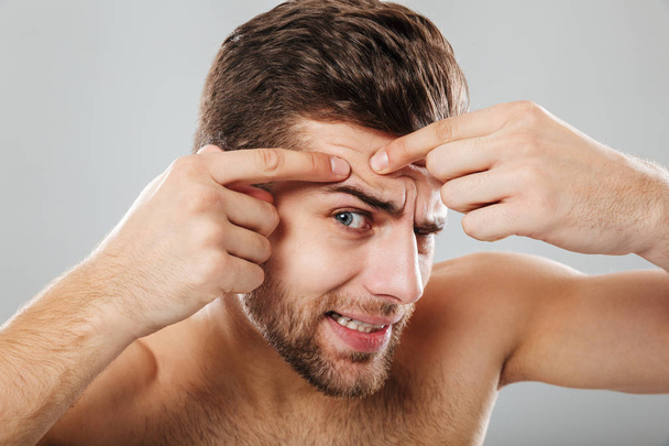 Close up portrait of a man squeezing pimple - Zdjęcie, obraz