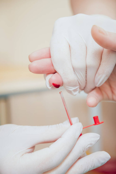 Nurse taking a blood sample. Medical equipment. Blood test - Фото, изображение