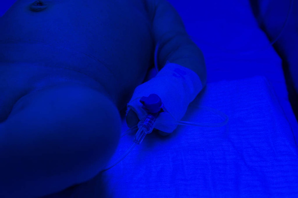 Noworodek noworodka leczenie żółtaczki pod ultravi - Zdjęcie, obraz