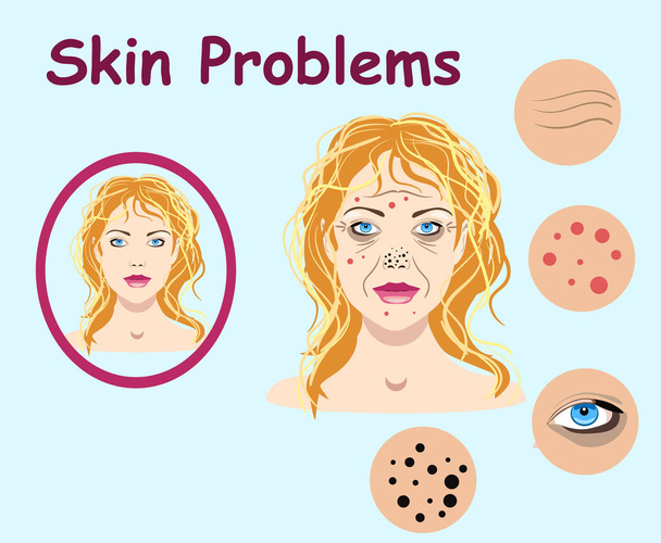 Frauen stehen vor Hautproblemen. Vektor-Illustration für kosmetische - Vektor, Bild