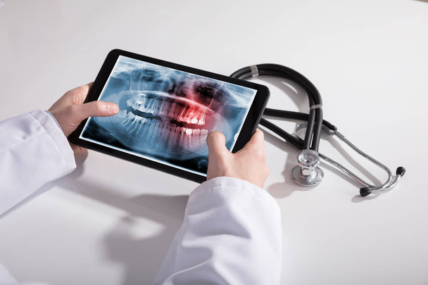 Doctor's Hand And Digital Tablet Screen Showing Teeth X-ray With Stethoscope On White Desk - Photo, Image