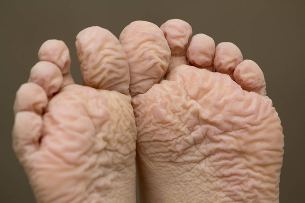 Primer plano de los niños arrugados pies después de baño largo
 - Foto, imagen