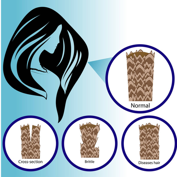 Hair brittleness are,  hair,  brittle,  art,  icon,  logo,  people, - Vector, Image