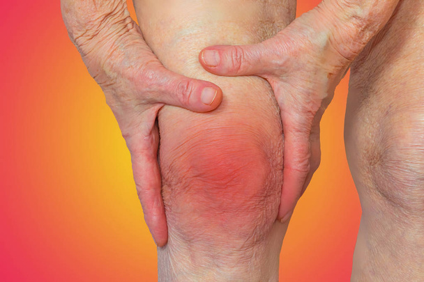 Старша жінка тримає коліно з болем
 - Фото, зображення