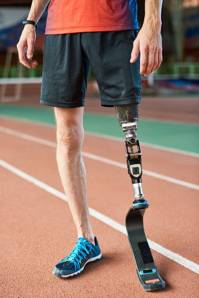 Felismerhetetlen Amputáltak sportoló pózol a modern edzőteremben futópálya lábak - Fotó, kép