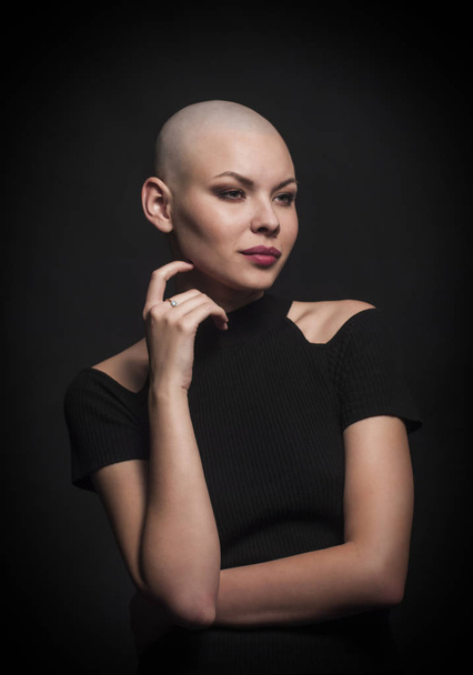 Emotional portrait of girl shaved bald. - Valokuva, kuva