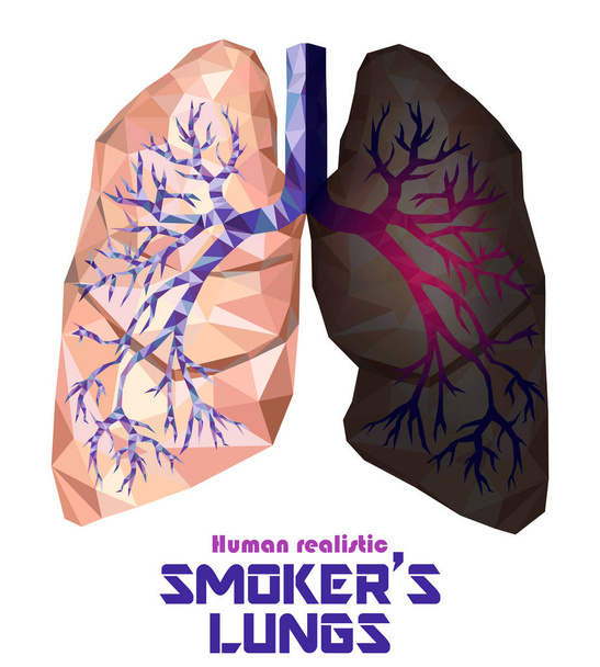 Pulmones humanos poco realistas y bronquios con inflamación del cáncer
 - Vector, Imagen